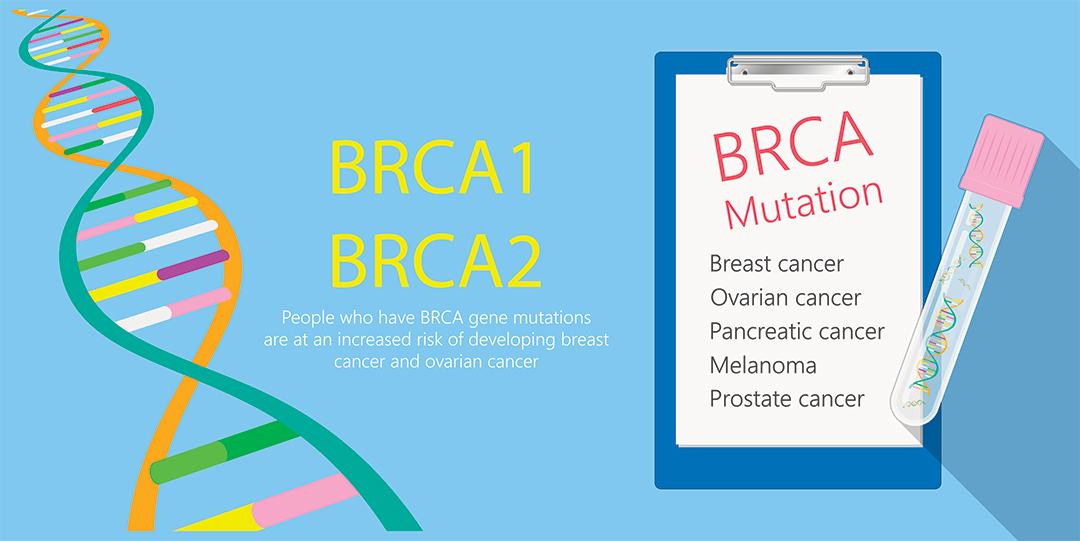 4bases’ paper of the month December 2020 “BRCA testing in a genomic
